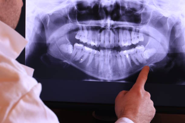 Best Emergency Dentist for Knocked-Out Tooth in Rmichael, CA
