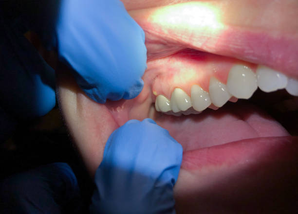 Best Emergency Dentist for Special Needs Patients in Rmichael, CA